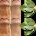 These visible signs may be hiding liver disease