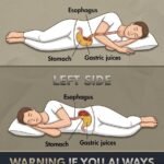 5 Critical Health Signals of a Mini Stroke in Seniors That Shouldn’t Be Ignored