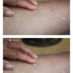 5 Signs of a Mini Stroke in the Elderly