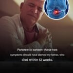 7 EARLY SIGNS of ALZHEIMER’S DISEASE that you SHOULD