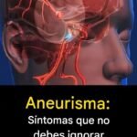 10 Early Warning Signs of a Stroke Everyone Should Know to Take Prompt Action