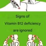These visible signs may be hiding liver disease