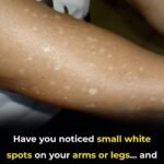 Your Feet Are a “Blood Sugar Meter” – Beware of Diabetes If You Frequently Experience These 12 Symptoms
