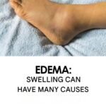 Brittle or weak nails may signal… see more