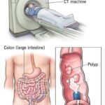 High blood pressure, high cholesterol: Avoid these 3 habits in the morning