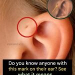 Why Earwax Buildup Happens and How It Can Affect Your Daily Life