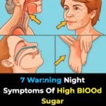 12 Worst Side Effects of Amlodipine You Should NEVER Ignore!