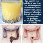 How to Get Rid of Milia: Those Annoying Fat Cysts