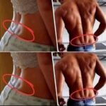 10 Early Warning Signs of a Stroke Everyone Should Know to Take Prompt Action