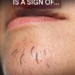 Weak or Brittle Nails: What Your Body Is Trying to Tell You