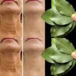10 Warning Signs of a Blood Clot in the Leg You Should Know