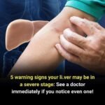 Top 8 Fruits That May Help Support Your Body’s Natural Blood Clot Management