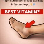 Who Is Most at Risk of Night Cramps?