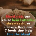 23 Strange Signs Your Kidneys Might Be in Trouble