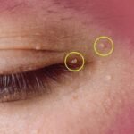 A woman’s chin hair is a sign of…See more