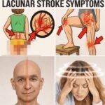 10 Early Warning Signs of a Stroke Everyone Should Know to Take Prompt Action