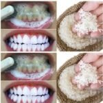 in two minutes remove 10 years of stains from teeth!! Results will Shock You