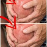 10 Early Warning Signs of a Stroke Everyone Should Know to Take Prompt Action