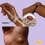 This natural and effective remedy for relieving constipation