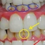 The Real Causes of Constant Phlegm and Mucus in Throat and How to Get Rid of It