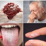 The 5 Most Laxative Foods in the World: Natural Remedies to Combat Constipation