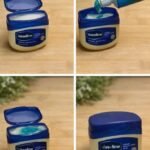 How to Get Rid of Milia: Those Annoying Fat Cysts