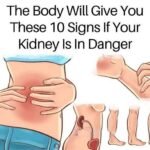 These visible signs may be hiding liver disease