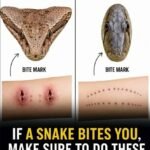 Small White Spots on Arms and Legs You Need To Know