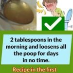 Who Is Most at Risk of Night Cramps?