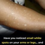 Did you know that drinking water on an empty stomach could be…