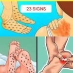 12 Worst Side Effects of Amlodipine You Should NEVER Ignore!