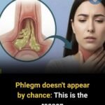 How to Get Rid of Phlegm and Mucus in Chest and Throat Naturally