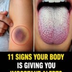 Left Side Body Pain: What It Could Mean and When to Pay Attention