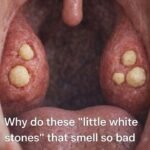 THE MOST POTENT HERB THAT DESTROYS PARASITES, URINARY TRACT & BLADDER INFECTIONS, HERPES, AND FLU VIRUSES