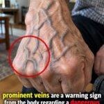 Weak or Brittle Nails: What Your Body Is Trying to Tell You
