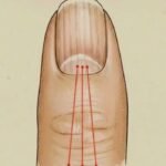 Left Side Body Pain: What It Could Mean and When to Pay Attention