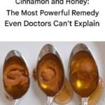 Discovering the 10 Most Common Side Effects of Metoprolol: A Helpful Guide for Anyone Taking This Medication
