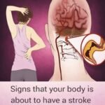 7 medications that cause severe dementia and profound brain damage