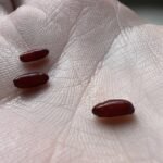 My mom taught me this trick to diminish dark age spots on my hands in just 3 mins with 0 effort. Here’s how it works
