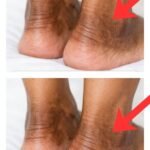 7 Common Nighttime Symptoms That May Be Associated with Diabetes Concerns