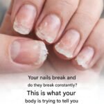 Add it to your cream and blemishes on your face will be a distant memory.