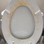 How to Get Rid of Milia: Those Annoying Fat Cysts