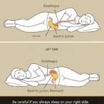 10 Early Warning Signs of a Stroke Everyone Should Know to Take Prompt Action