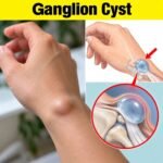 One month before a heart attack, your feet will warn you of these 6 signs, especially to the 3th