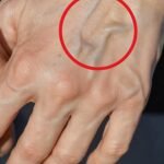 Healing Power And Important Safety Tips Of Castor Leaves