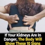 9 Warning Signs Your Kidneys Are Failing | Tests to Avoid Dialysis