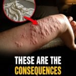 How to know if you have intestinal parasites and what to do to get rid of them