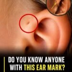 23 Strange Signs Your Kidneys Might Be in Trouble