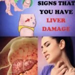 Waking up with dry mouth? Here’s what your body might be telling you 1