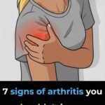 Cholesterol: 5 symptoms that warn you it’s too high(1 / 2)